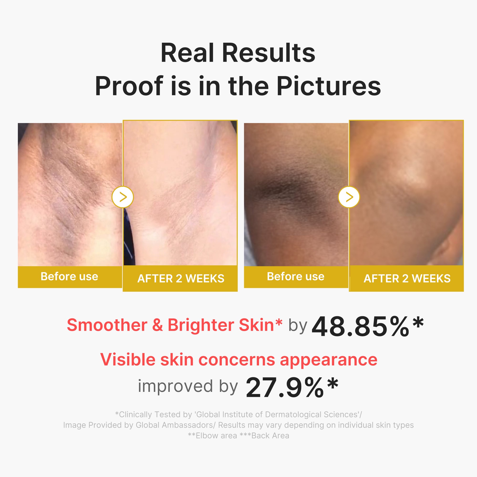 Kojic Acid Turmeric Body Peel Shot - Image 3